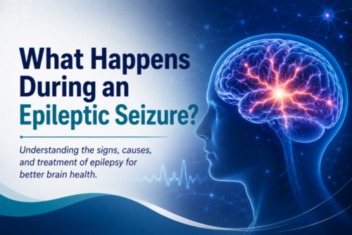 What Happens During an Epileptic Seizure? A Neurologist Explains